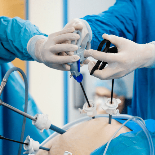 Minimally Invasive Surgery Process